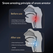 Smart Anti Snoring Device